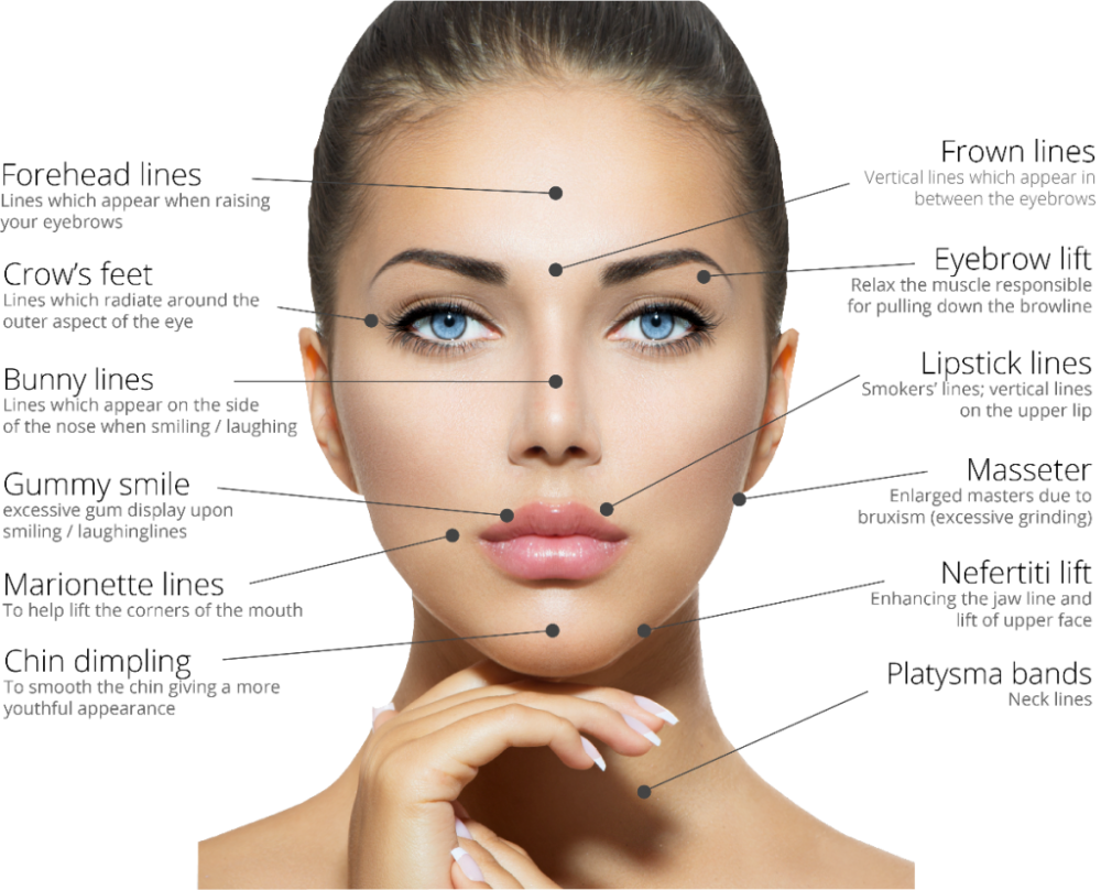 Cosmetic wrinkle treatment